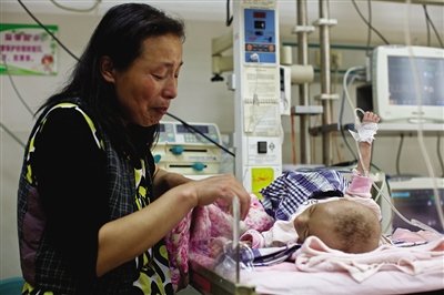 “骷髅女婴”进京求医 一天获捐超20万元(图)